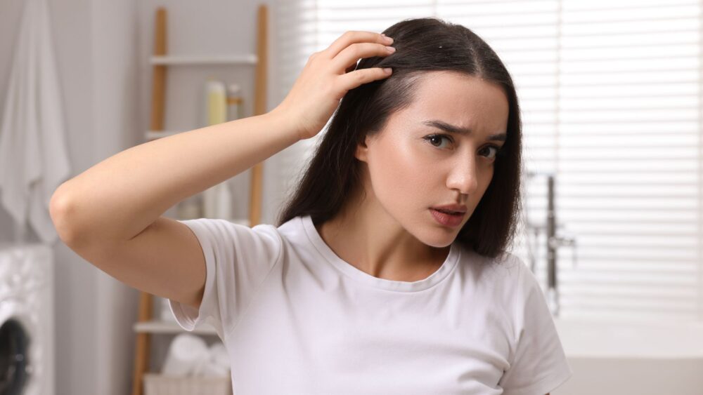 Wszy na głowie – co oznacza sen o wszach?